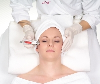 Kosmetik Microdermabrasion